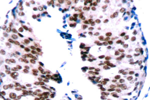 STAT5A Antibody (phospho-Ser780)