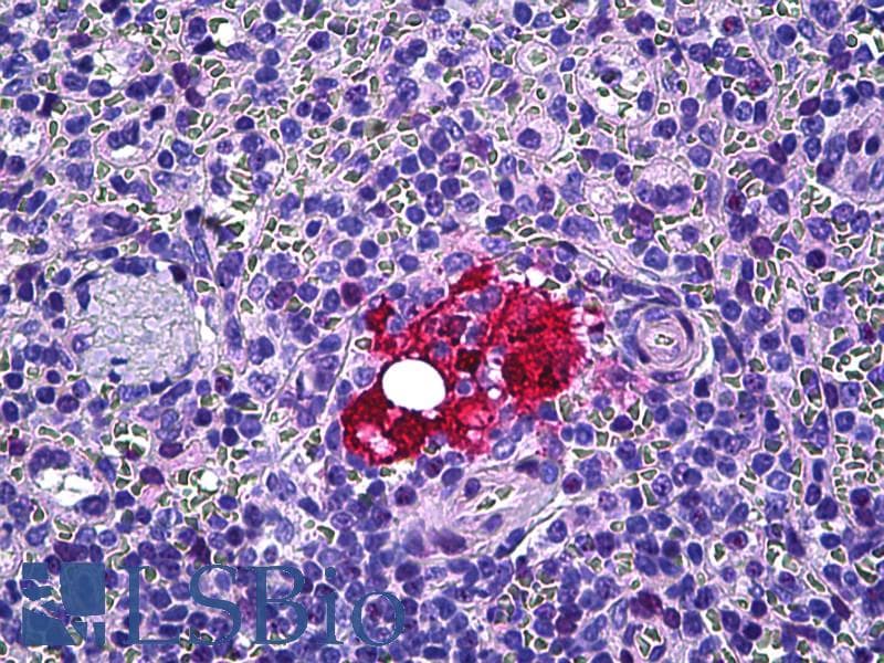 PathPlus™ LGALS3 / Galectin 3 Antibody (aa141-190)