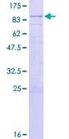 Human ZNF280B Protein (Recombinant GST)