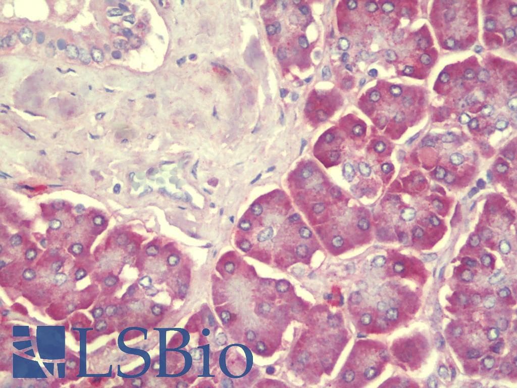 IHC-plus™ SEC62 / TP-1 Antibody