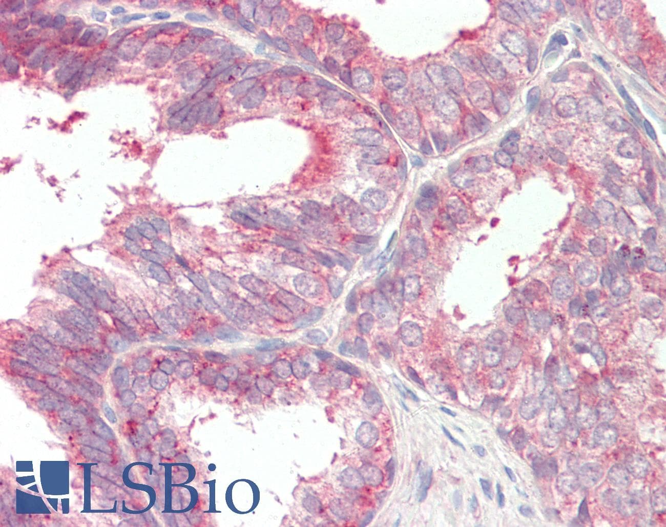 IHC-plus™ CD47 Antibody (aa23-140)