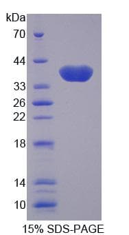 Human SLC25A11 Protein (Recombinant His, N-Terminal)