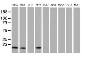 DSTN / Destrin Antibody (clone OTI2C10)