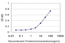 TTC3 Antibody (clone 2D10)