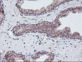 PGAM2 Antibody (clone OTI1C1)