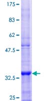 Human SOAT1 Protein (Recombinant GST, N-terminus)