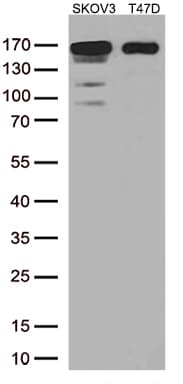 ERBB2 / HER2 Antibody (aa676-1255, clone UMAB33)