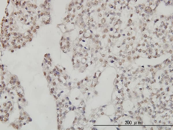 DP97 / DDX54 Antibody (clone 2H6)