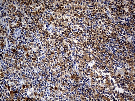Monoclonal Mouse anti-Human DAPP1 / BAM32 Antibody (clone OTI7D4, Carrier-free, IHC, WB)