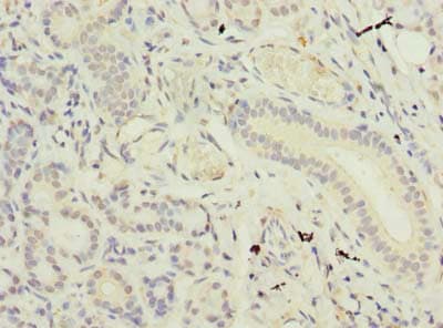 SUSD4 Antibody