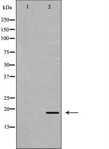 APRT Antibody
