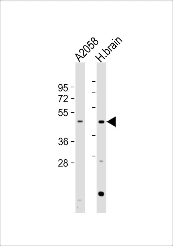 PRLHR / GPR10 Antibody