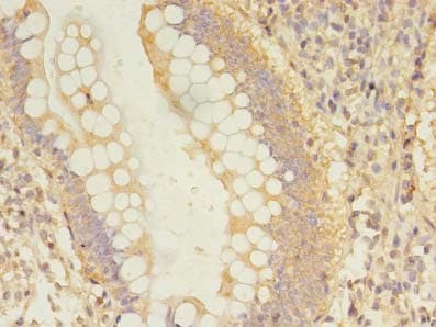 Dynactin 2 / Dynamitin Antibody