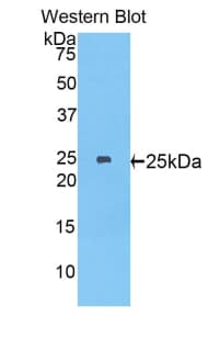 MYH8 Antibody (aa40-240, PE)