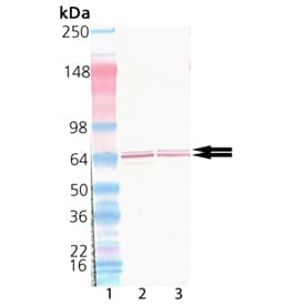GAD / Glutamate Decarboxylase Antibody