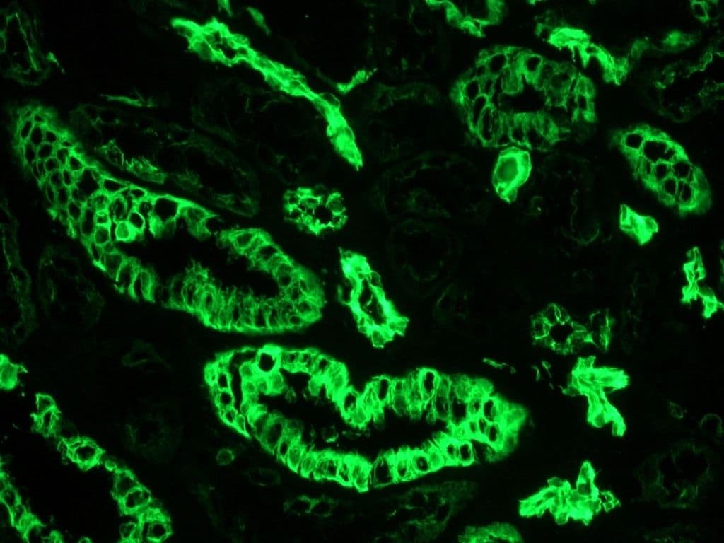 PathPlus™ Monoclonal Mouse anti-Human KRT7 / CK7 / Cytokeratin 7 Antibody (clone OVTL12/30, IHC, WB)