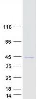 Human FBXO4 / FBX4 Protein (Recombinant Myc-DDK (Flag))