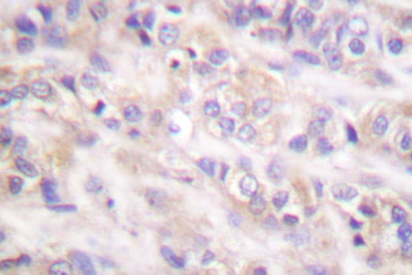 SYK Antibody (Phe169)
