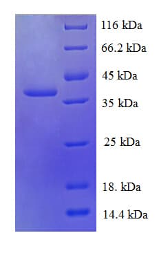 Human RPL30 / Ribosomal Protein L30 (Recombinant GST)
