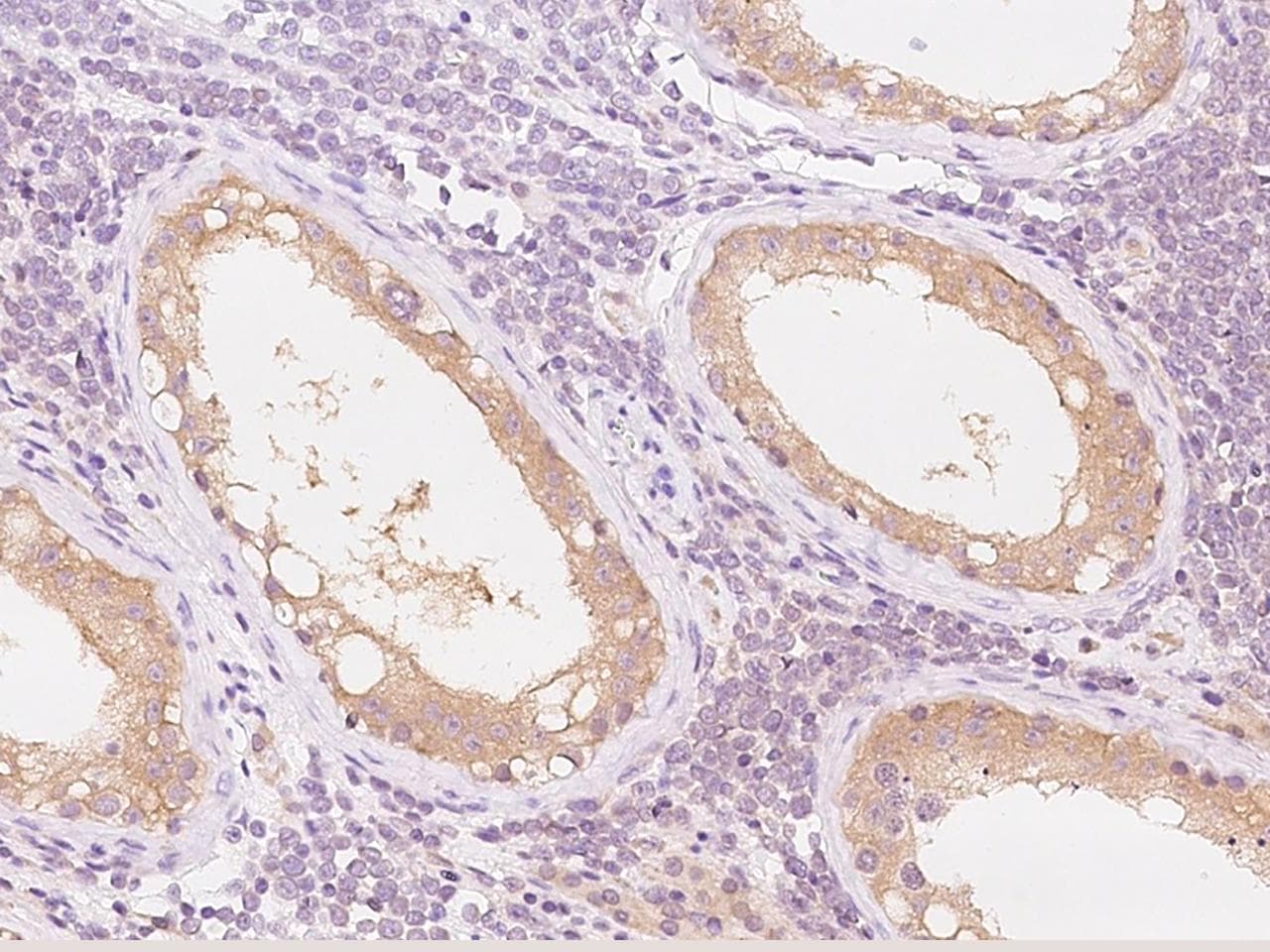 PRICKLE2 Antibody