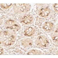 TMIGD2 Antibody