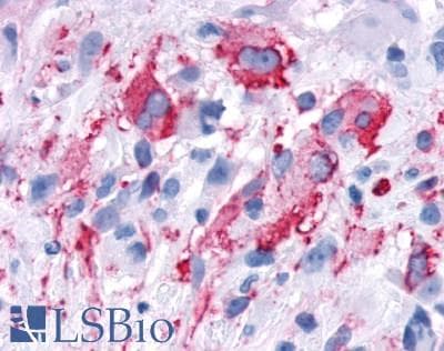 PathPlus™ FAK / Focal Adhesion Kinase Antibody (C-Terminus)