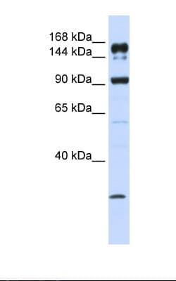 Polyclonal Rabbit anti-Human ABCA5 Antibody (aa1296-1345, IHC, WB)