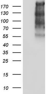 Monoclonal Mouse anti-Human TG / Thyroglobulin Antibody (clone OTI1F1, aa20-358, IHC, WB)