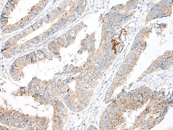 GARNL3 Antibody