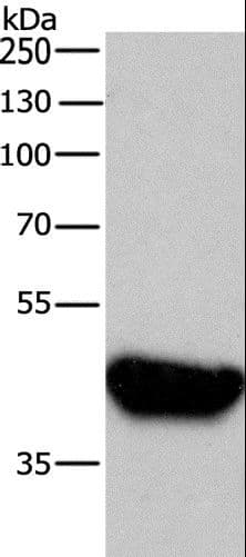 Polyclonal Rabbit anti-Human BRCC45 / BRE Antibody (IHC, WB)