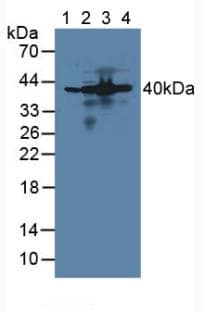 AIMP1 / EMAP II Antibody (aa2-310)