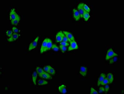 Polyclonal Rabbit anti-Human TREM2 / TREM-2 Antibody (IHC)