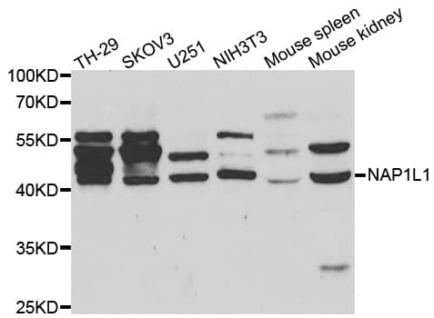 Polyclonal Rabbit anti-Human NAP1L1 Antibody (IHC, WB)
