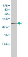 Monoclonal Mouse anti-Human CTBS / CTB Antibody (clone 1B5-1B9, WB)