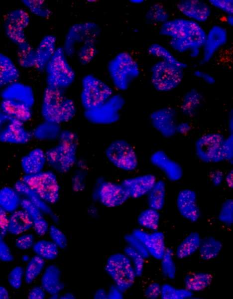 Polyclonal Rabbit anti-Human PLRG1 Antibody (aa464-514, IHC, IF)