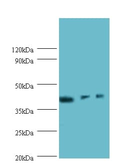 ILKAP Antibody (HRP)