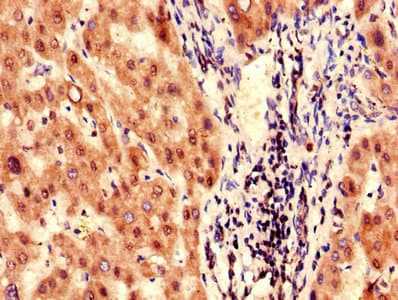 Polyclonal Rabbit anti-Human FAH Antibody