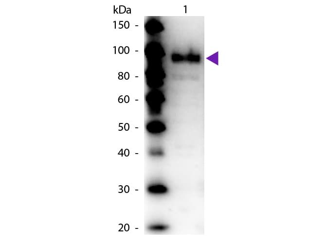 Phosphoenolpyruvate carboxylase Antibody (Liquid)