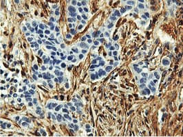 Monoclonal Mouse anti-Human TAGLN / Transgelin / SM22 Antibody (clone 8C8, Carrier-free, IHC, IF, WB)