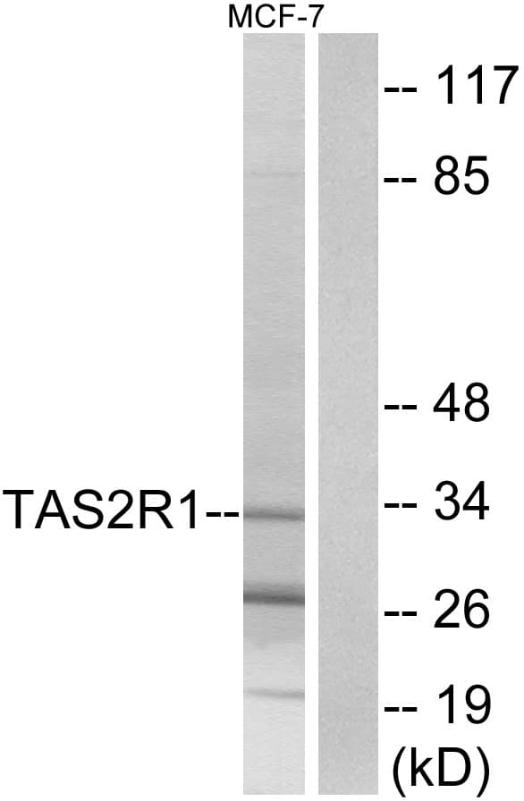 TAS2R1 Antibody (aa6-55)