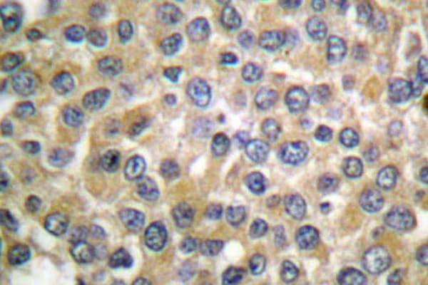 Polyclonal Rabbit anti-Human MLANA / Melan-A Antibody (Pro75, IHC, WB)