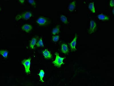 CCDC109B Antibody