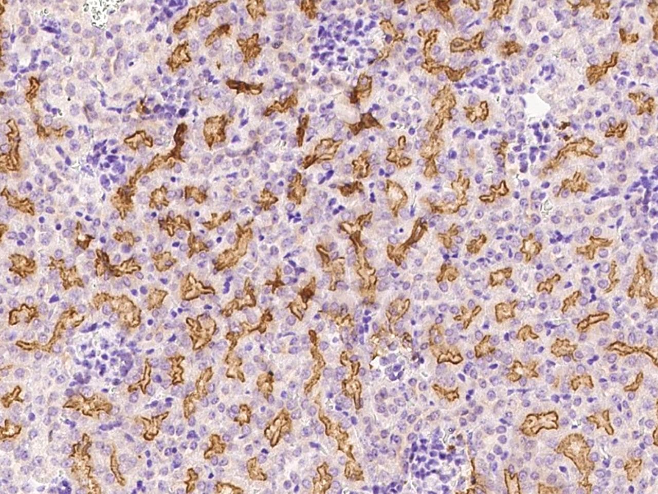 EPHB2 / EPH Receptor B2 Antibody (Preservative Free)
