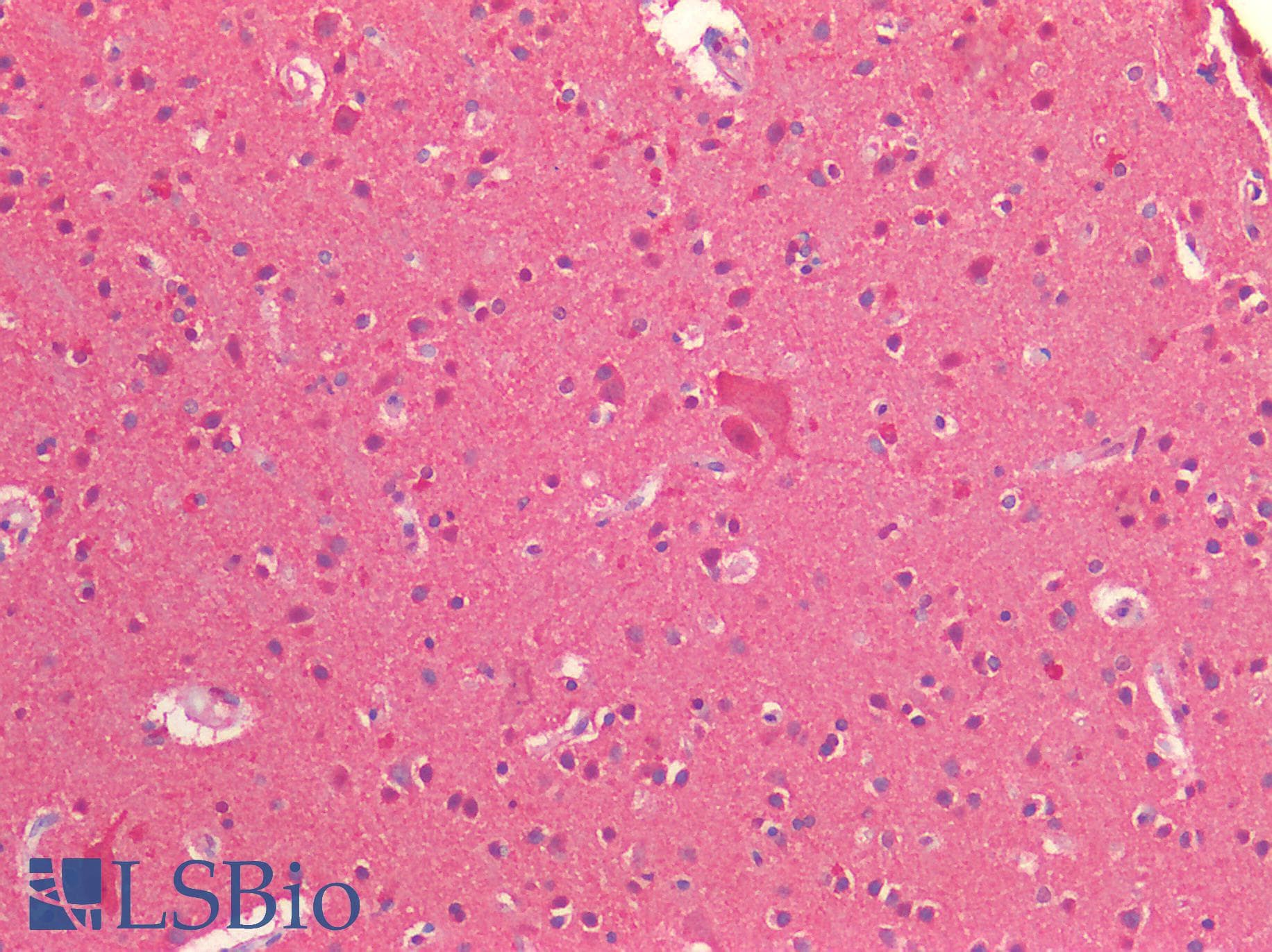 PathPlus™ Polyclonal Rabbit anti-Human BAD Antibody (IHC, WB)