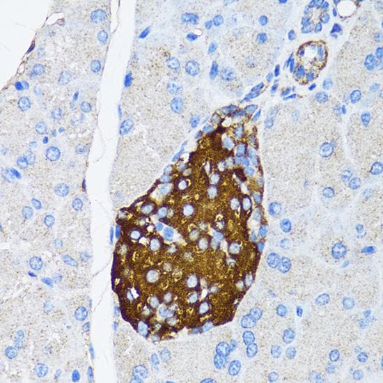 TIMP2 Antibody