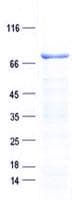 Human ALAS1 Protein (Recombinant His, N-Terminal)