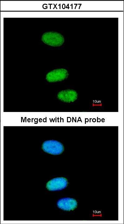 IHC-plus™ SOX13 Antibody (aa75-520)