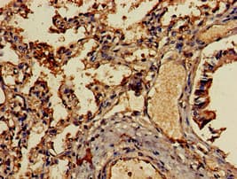 IHC-plus™ CCL13 / MCP4 Antibody