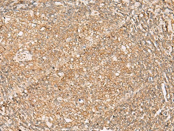 FNTB Antibody