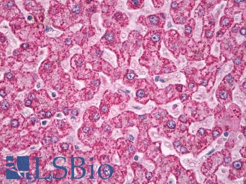 SOD2 / Mn SOD Antibody (FITC)